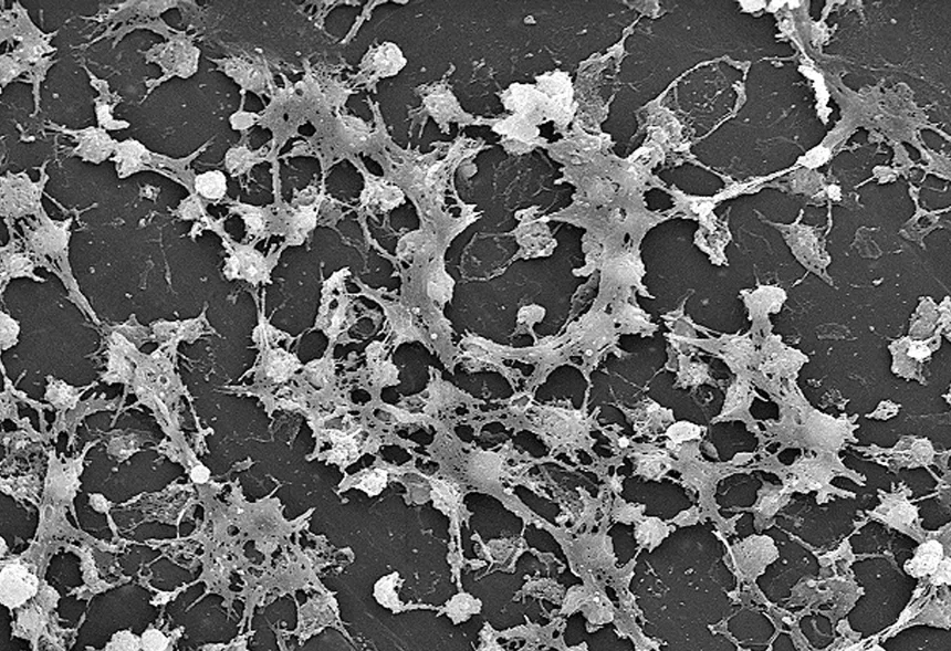 Biofilm bactérien observé au microscope électronique à balayage